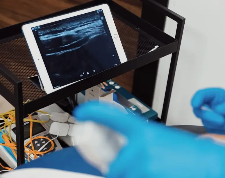 Fisioterapia con ecografía musculoesqueletica en Alicante, Chema Diago DPClinic